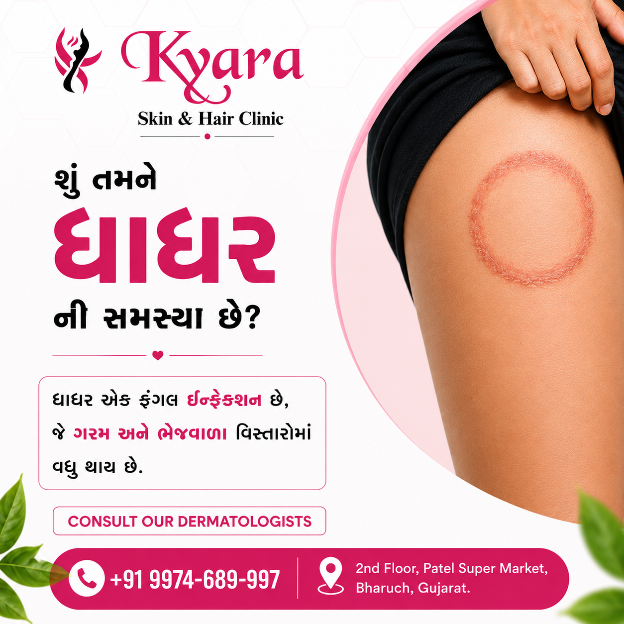 Understanding Dhadhar (Ringworm)
